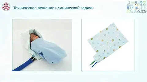 "Терапевтическая гипотермия новорожденных" - Конгресс РАСПМ 2022