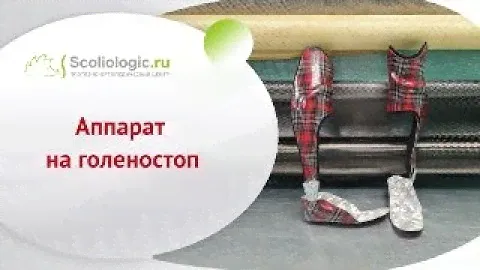 Такие нужные и красивые аппараты на голеностопные суставы!
