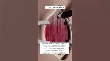 #операция #трахеостомия #трахеотомическаятрубка