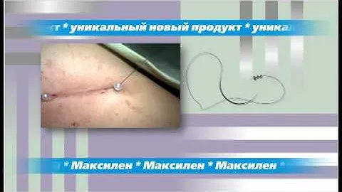 Эргон Эст шовный материал