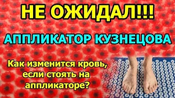 Кровь после аппликатора Кузнецова. Не ожидал