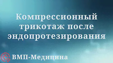 Компрессионные чулки и бинты после эндопротезирования | ВМП-Медицина